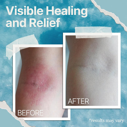 Natural Soothing Eczema Cream | Relief & Repair