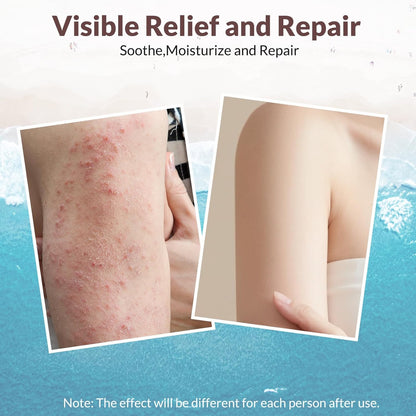 Natural Soothing Eczema Cream | Relief & Repair